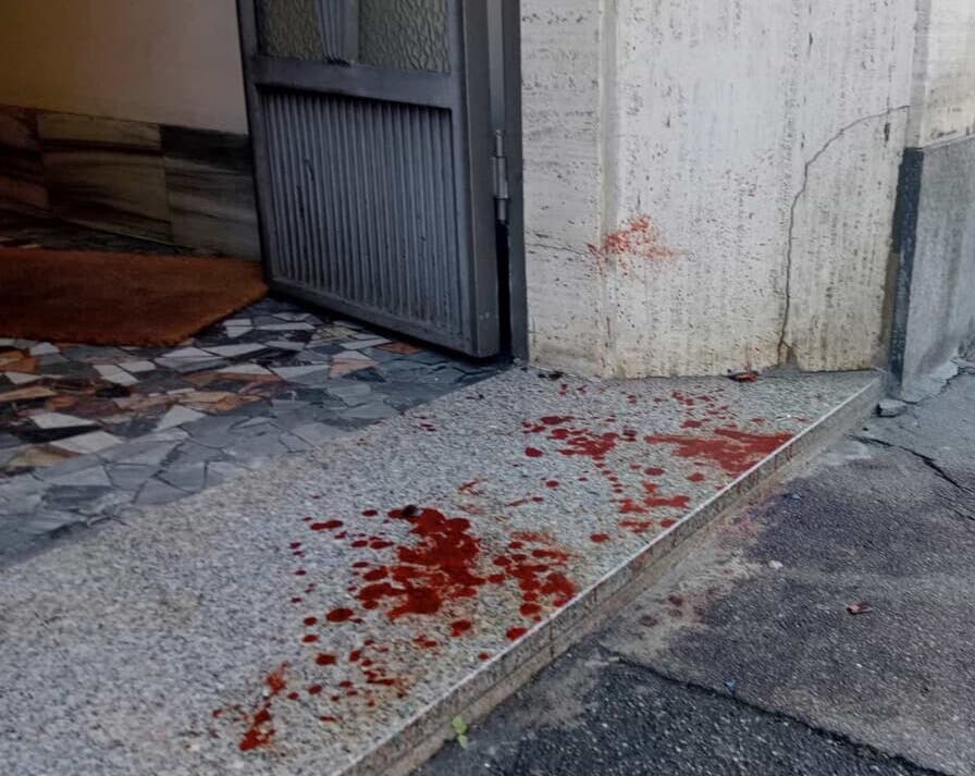 adn24 torino | giovane accoltellato alla gola tutto iniziato con una lite in strada si cerca laggressore