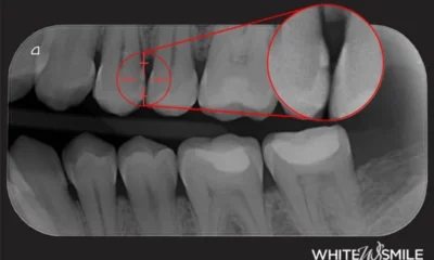 adn24 denti umani e denti animali tutto quello che non sai