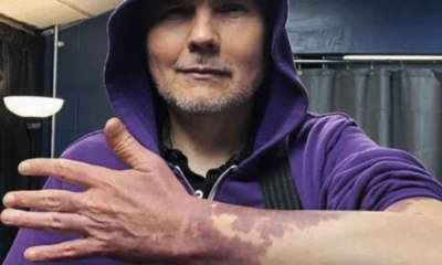 adn24 billy corgan celebra la sua unicità mostrando il nevo vinoso